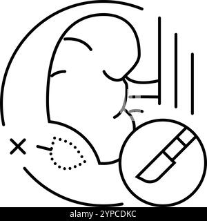 illustration vectorielle d'icône de ligne hospitalière de chirurgie de néphrectomie Illustration de Vecteur