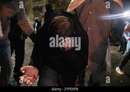 Tbilissi, Géorgie. 29 novembre 2024. Un manifestant pro-européen tient sa tête qui saigne après avoir été frappé à la tête par une pierre, lancée par la police lors d'une manifestation antigouvernementale. À la suite d'élections controversées le mois dernier, le premier ministre Irakli Kobakhidze, parti au pouvoir, a annoncé hier qu'il ne poursuivrait plus un avenir européen avant la fin de 2028. Les gens se sont rassemblés dans les rues hier soir et ce soir face à des gaz lacrymogènes, des canons à eau et de nombreuses arrestations. Crédit : SOPA images Limited/Alamy Live News Banque D'Images