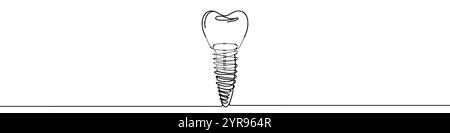 Une illustration en ligne continue de l'implant dentaire, isolé sur fond blanc. Dessin au trait de l'implant dentaire Illustration de Vecteur