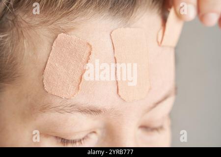 Gros plan d'un jeune homme caucasien adulte avec des bandages adhésifs sur le front pour la récupération des blessures. Banque D'Images