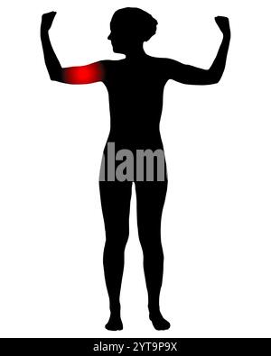 Vue avant de la femme souffrant de douleurs dans le haut du bras Banque D'Images