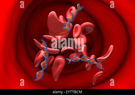 Thérapie génique dans la drépanocytose - vue en coupe illustration 3D. Banque D'Images