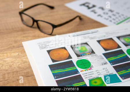 Une paire de lunettes et un rapport maculaire comprenant des graphiques oculaires et des scans OCT. Concept de santé oculaire et de soins de la vue. Banque D'Images