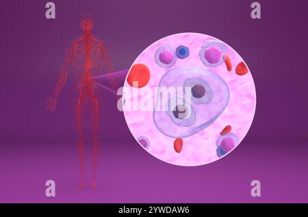 Lymphome hodgkinien (HL) cellules dans le flux sanguin - vue isométrique illustration 3D. Banque D'Images