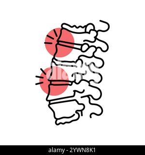 Icône de ligne de couleur arthrose de la colonne vertébrale. Maladies du rachis. Vertebrology. Elément isolé par vecteur. Contour modifiable. Illustration de Vecteur