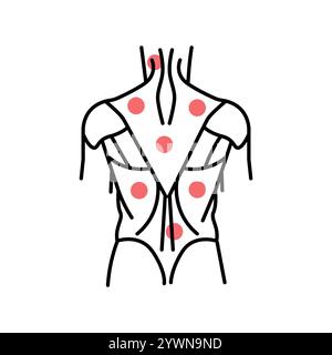 Icône de ligne de couleur du syndrome douloureux myofascial. Maladies du rachis. Vertebrology. Elément isolé par vecteur. Contour modifiable. Illustration de Vecteur