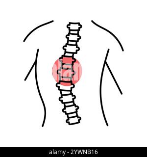 Icône de ligne de couleur scoliose. Maladies du rachis. Vertebrology. Elément isolé par vecteur. Contour modifiable. Illustration de Vecteur