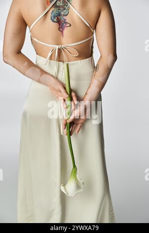 Jeune femme avec vitiligo tient un lis calla blanc, exsudant l'élégance et la grâce. Banque D'Images