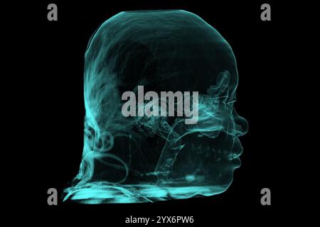 Tomodensitométrie (TDM) couleur d'une tête montrant les voies aériennes supérieures et les sinus paranasaux sains. Banque D'Images