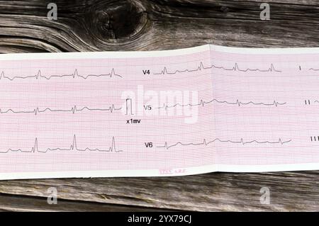 Le Caire, Egypte, 15 novembre 2024 : électrocardiographe ECG, un graphique qui dessine l'électricité du cœur et donne une idée sur la condition cardiaque et t Banque D'Images