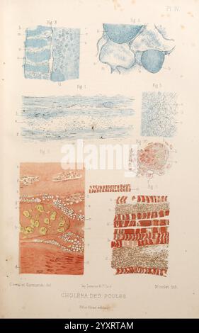 Les, bactéries, et, leur, rôle, dans, l'anatomie, et, l'histologie, pathologiques, des, maladies, infectieuses, Paris, F. Alcan, 1885, bactéries, bactériennes, infections, pathogénicité, pathologie, cette composition visuelle présente une série d’illustrations détaillées représentant diverses structures microscopiques liées à l’étude du choléra chez les poulets. La section supérieure présente différents types d'arrangements cellulaires et tissulaires, mettant en évidence les motifs complexes trouvés dans les échantillons biologiques. Vous trouverez ci-dessous des représentations éclatantes des bactéries et de leurs interactions dans les tissus, illustrant le Banque D'Images