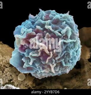Macrophage. Micrographie électronique à balayage coloré (MEB) d'un globule blanc macrophage au site d'une plaie cutanée. Les macrophages sont des cellules du système immunitaire du corps. On les trouve dans les tissus plutôt que dans le sang circulant. Les macrophages reconnaissent les particules étrangères, y compris les bactéries, le pollen et la poussière, et le phagocytose (engulf) et les digèrent. Grossissement : x4000 lors de l'impression à 10 centimètres de large. Banque D'Images