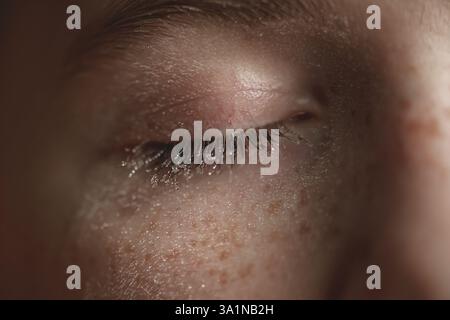 Gros plan extrême d'un œil fermé avec des cils mouillés et des taches de rousseur, mettant en valeur de minuscules gouttelettes d'eau, créant une image captivante de beauté et de vulpre Banque D'Images