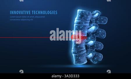 vecteur de colonne vertébrale 3d sur fond bleu. Soins chiropratiques, moelle épinière, chirurgie orthopédique. Illustration de Vecteur
