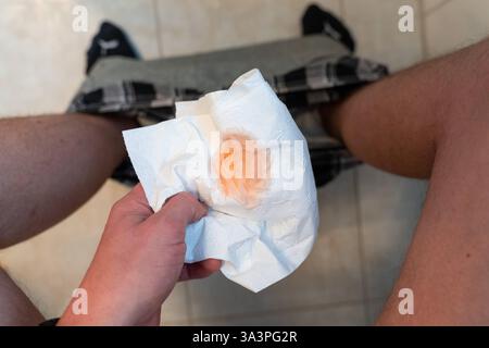 Bavière, Allemagne - 16 mars 2025 : une personne tient du papier toilette avec un sang caustique de décoloration orange. Cela peut indiquer des habitudes alimentaires, des problèmes digestifs ou d'autres facteurs de santé et doit être observé. *** Eine person hält Toilettenpapier mit einer orangefarbenen Verfärbung Kustblut. Dies kann auf Ernährungsgewohnheiten, Verdauungsprobleme oder andere gesundheitliche Faktoren hinweisen und sollte beobachtet werden. Banque D'Images