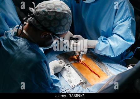 Gros plan équipe diversifiée de chirurgiens pratiquant la chirurgie sur un patient dans la salle d'opération de l'hôpital. Traitement urgent, chirurgie plastique. Banque D'Images