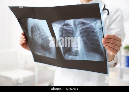 Docteur examinant la radiographie des poumons à l'hôpital, gros plan Banque D'Images