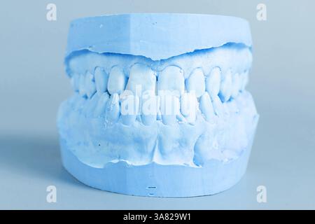 Cette image montre un gros plan détaillé d'un modèle dentaire bleu clair. Représente un ensemble de dents humaines, idéal à des fins éducatives ou médicales Banque D'Images