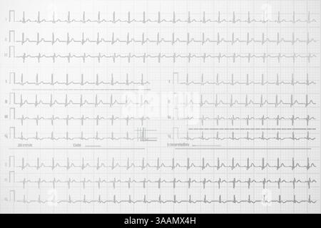 Lignes ECG sur fond papier, illustration vectorielle. Illustration de Vecteur