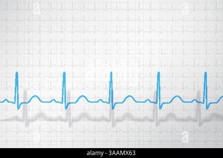 Graphique ECG normal de l'homme sain, fond de vecteur conceptuel. Illustration de Vecteur