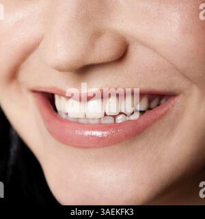 Belles dents blanches dans un sourire heureux parfait d'un visage féminin, concept de blanchiment dentaire dentiste, Atlanta, USA, Amérique du Nord Banque D'Images