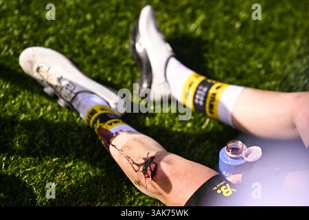 Roubaix, France. 12 avril 2025. Un genou blessé photographié après la course féminine de la course cycliste d'une journée 'Paris-Roubaix', 148, à 5 km de Denain à Roubaix, France, le samedi 12 avril 2025. BELGA PHOTO JASPER JACOBS crédit : Belga News Agency/Alamy Live News Banque D'Images