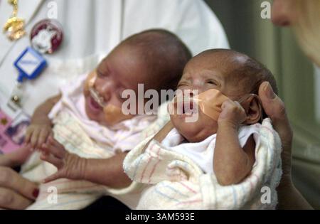 21 décembre 2004 - États-Unis - KRT US NEWS STORY SLUGGED : MED-TINYBABY KRT PHOTO PAR CARL WAGNER/CHICAGO TRIBUNE (21 décembre) MAYWOOD, il -- les infirmières tiennent les sœurs jumelles Hiba Rahman, à gauche, et Rumaisa Rahman lors d'une conférence de presse avec leurs parents au centre médical de l'Université Loyola à Maywood, Illinois, le mardi 21 décembre 2004. Rumaisa Rahman pesait 8,6 onces à sa naissance le 19 septembre 2004. Sa sœur Hiba pesait 1 livre 4 onces. (MvW) 2004 (crédit image : © Chicago Tribune/mct/ZUMAPRESS.com) Banque D'Images