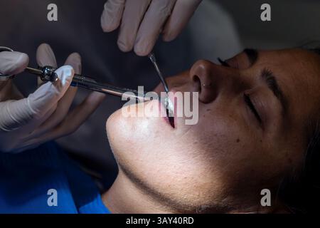 Vue rapprochée d'un nettoyage des dents, montrant un patient en cours d'examen buccal. Le dentiste utilise des outils de précision pour vérifier l'état du PA Banque D'Images