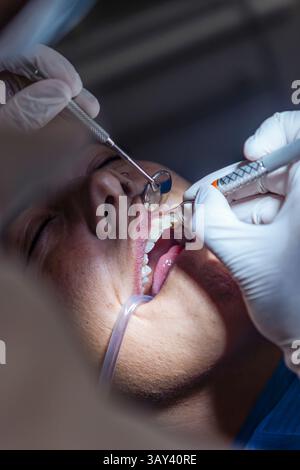 Un dentiste portant des gants effectue un nettoyage des dents à l'aide d'une seringue et d'outils dans la bouche d'un patient. L'image met en évidence les soins dentaires professionnels et hyg Banque D'Images