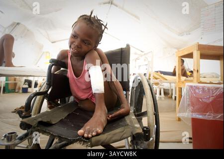 01 juil. 2010 - Port au Prince, Haïti - MIRLANDA PIERRE, 12 ans, a perdu sa jambe en raison de blessures qu'elle a subies lors du tremblement de terre haïtien. Elle a été retirée des décombres d'une maison voisine trois jours après le tremblement de terre. Milanda reçoit une prothèse de jambe de handicap International. Six mois après le séisme, de nombreux patients qui ont perdu des membres sont guéris au point où ils peuvent être équipés de prothèses plus permanentes. (Crédit image : © Jessica Brandi Lifland/ZUMApress.com) Banque D'Images