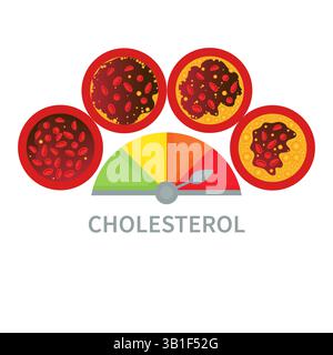 Échelle de taux de cholestérol, illustration. Jauge de mesure des lipoprotéines LDL et HPL. Indicateur de test à teneur élevée et faible en graisse. Indicateur de risque d'athérosclérose. Banque D'Images