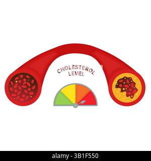 Taux de cholestérol, illustration conceptuelle. Jauge de mesure des lipoprotéines LDL et HPL. Indicateur de test à teneur élevée et faible en graisse. Indicateur de risque d'athérosclérose. Banque D'Images