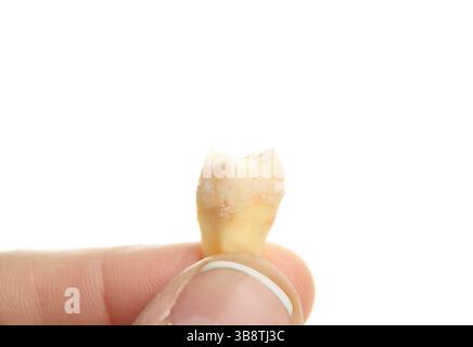 Main tenant la dent de sagesse après extraction. Dent de sagesse réelle ou troisième molaire avec racine et couronne visibles. Soins dentaires ou anatomie clinique refere Banque D'Images