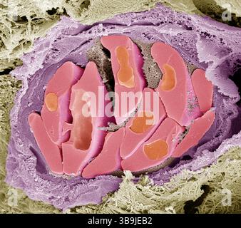Globules rouges d'oiseau. Micrographie électronique à balayage couleur (MEB) des globules rouges fracturés (érythrocytes, rouges) dans un vaisseau sanguin aviaire. Ces cellules contiennent de l'hémoglobine, un pigment qui leur permet de transporter l'oxygène dans tout le corps. Les globules rouges non mammaliens (tels que ceux-ci) sont de forme ovale (discoïde) et contiennent un noyau cellulaire. Les globules rouges humains sont en forme de disque et ne possèdent pas de noyau cellulaire. La fibrine (utilisée dans la coagulation du sang) peut être observée entre les cellules. Le tissu conjonctif entoure le vaisseau sanguin. Grossissement : x4000 lors de l'impression de 10 centimètres de large. Banque D'Images