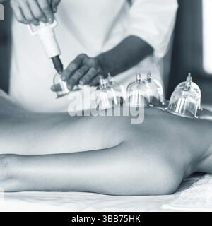 Femme allongée sur la poitrine avec traitement de cupping sur le dos Banque D'Images