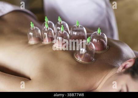 Femme allongée sur la poitrine avec traitement de cupping sur le dos Banque D'Images