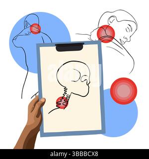 Illustration vectorielle isolée de douleurs des vertèbres cervicales. Tracé du contour de la région cervicale avec localisation de la douleur dans les vertèbres. Illustration de Vecteur