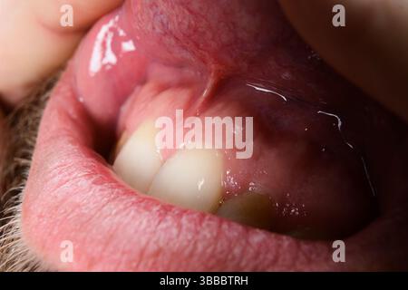 Vue détaillée de l'intérieur de la bouche d'une personne, mettant en évidence les dents, les gencives, la langue et la salive. L'image se concentre sur les textures et l'humidité de la cavité buccale. Banque D'Images