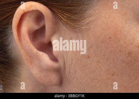 Rides préauriculaires devant les oreilles sur le visage de la femme Banque D'Images