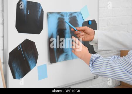 Médecin masculin montrant une radiographie des poumons sur le tableau magnétique au patient en clinique, gros plan Banque D'Images
