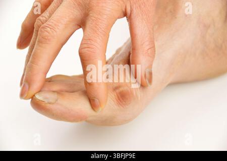 Image en gros plan de la main vérifiant l'oignon de pied souffrance.image de studio horizontale sur fond blanc. Banque D'Images