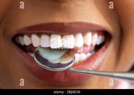 Gros plan de la bouche ouverte d'un patient montrant des dents reflétant dans un miroir dentaire tenu par un dentiste lors d'un examen Banque D'Images