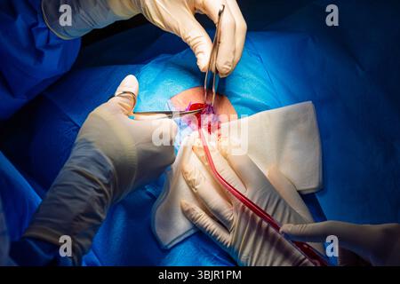 Chirurgie dermatologique au bloc opératoire. Découpe de la lésion et fluides d'aspiration.carcinome épidermoïde.les mains d'un chirurgien et de son assistan Banque D'Images