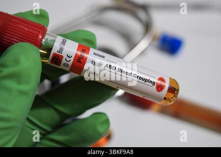 Groupage sanguin ABO - test avec échantillon sanguin. Vue de dessus isolé sur le bureau. Santé ou concept médical Banque D'Images