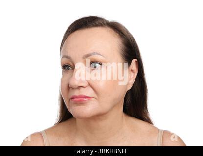 Femme avant la procédure cosmétique sur fond blanc Banque D'Images