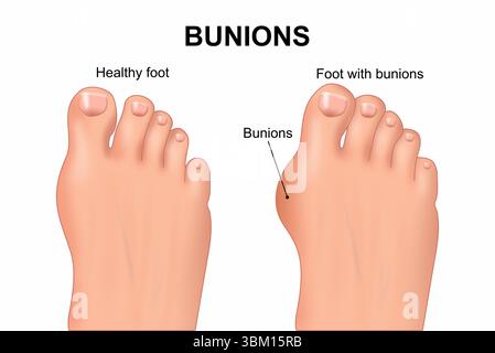 Oignons Banque D'Images