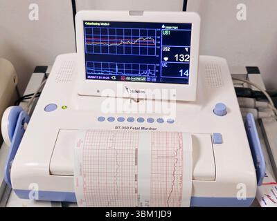 Le Caire, Egypte, 17 juin 2025 : appareil de cardiotocographie placé sur l'abdomen de la mère enregistrant la fréquence cardiaque fœtale obtenue via un transducteur à ultrasons, CTG Banque D'Images