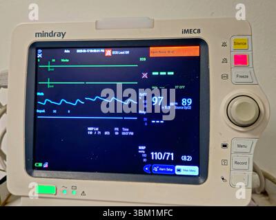 Le Caire, Égypte, 17 juin 2025 : moniteur médical des signes vitaux pour la mesure des signes vitaux importants pour les patients, comme la pression artérielle, le rat cardiaque Banque D'Images