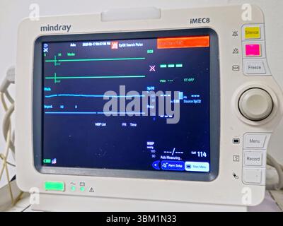 Le Caire, Égypte, 17 juin 2025 : moniteur médical des signes vitaux pour la mesure des signes vitaux importants pour les patients, comme la pression artérielle, le rat cardiaque Banque D'Images