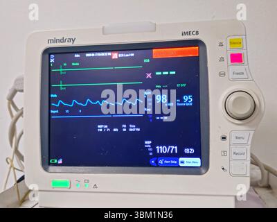 Le Caire, Égypte, 17 juin 2025 : moniteur médical des signes vitaux pour la mesure des signes vitaux importants pour les patients, comme la pression artérielle, le rat cardiaque Banque D'Images
